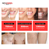 Diode laser hair removal alibaba machine hot selling