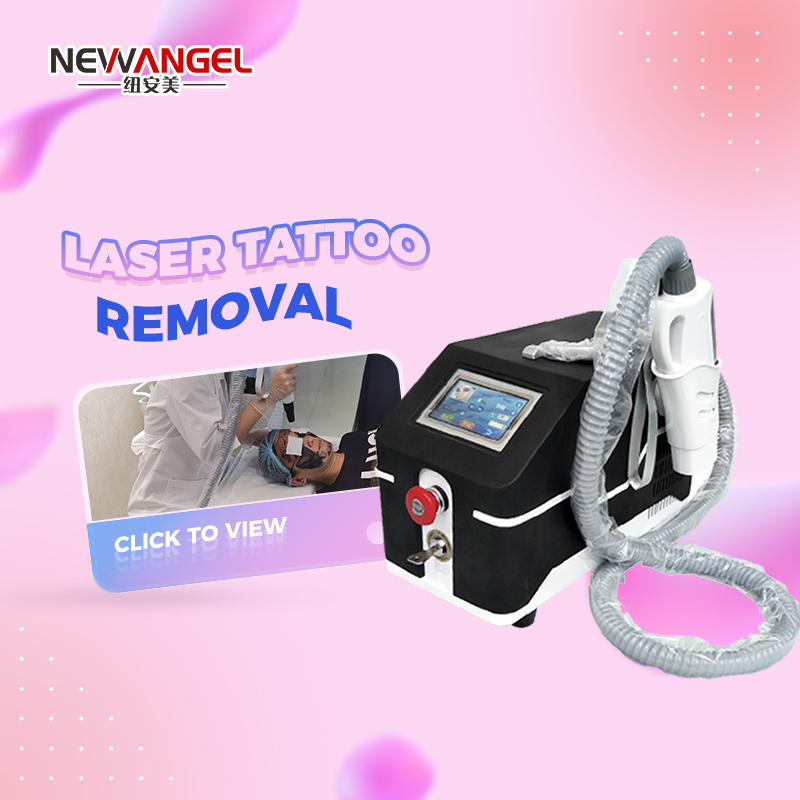 New design ND YAG laser tattoo removal machine price BM20
