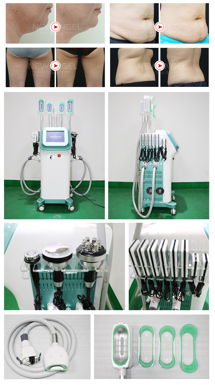Laser belly fat removal cost machine rf cavitation for beauty salon use