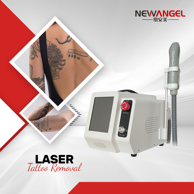 ND YAG Laser Machine Tattoo Removal