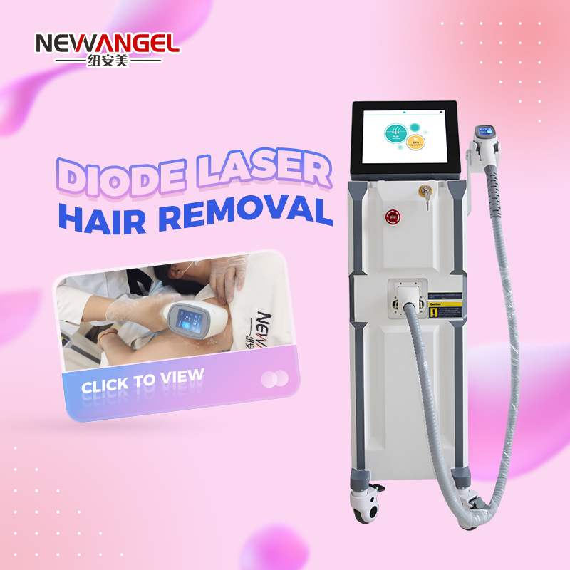 Best laser hair removal machine from spain