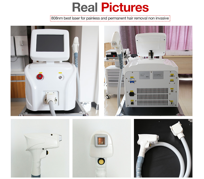Best commercial laser hair removal machine professional
