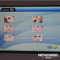 ND YAG best tattoo removal laser machine cost