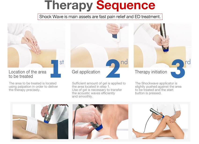 Low Intensity Extracorporeal Shockwave Treatment For Ed